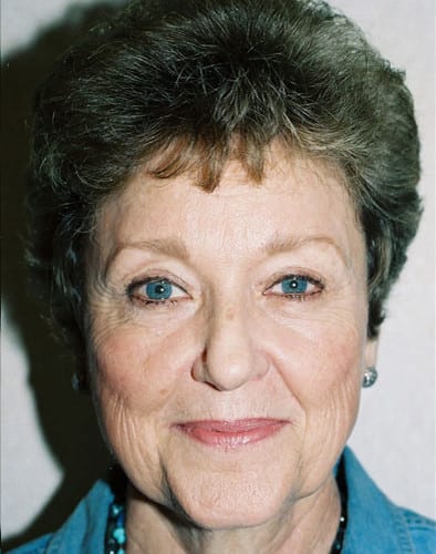 Blepharoplasty-01 | After Blepharoplasty