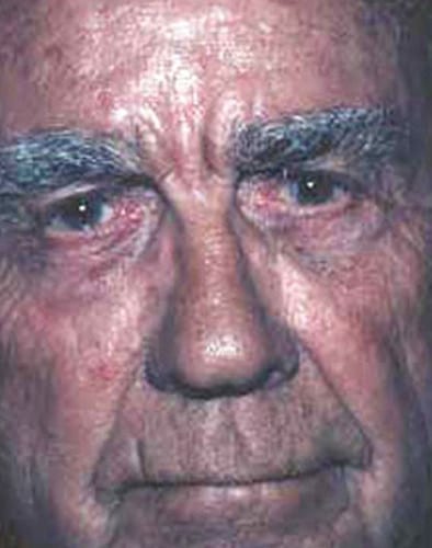 Male-Cosmetic-Surgery-03 | After Male Cosmetic Surgery