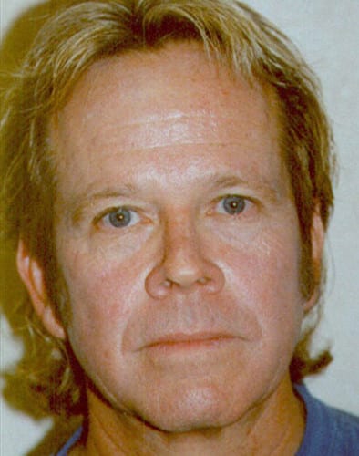 Male-Cosmetic-Surgery-04 | Before Male Cosmetic Surgery