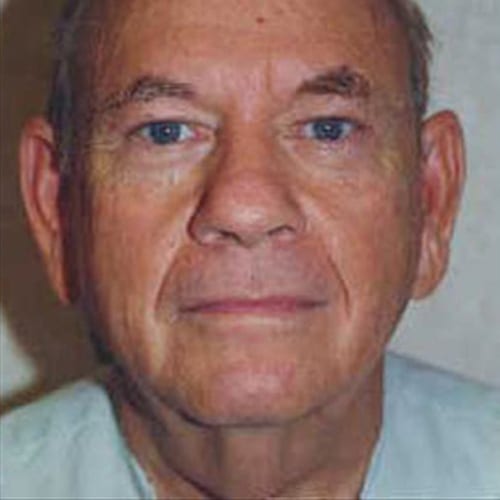 Male-Cosmetic-Surgery-05 | Before Male Cosmetic Surgery 1