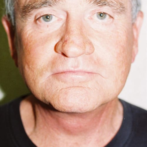 Male-Cosmetic-Surgery-06 | After Male Cosmetic Surgery 2