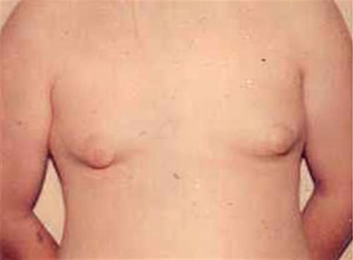 Male-Cosmetic-Surgery-07 | Before Male Cosmetic Surgery 2