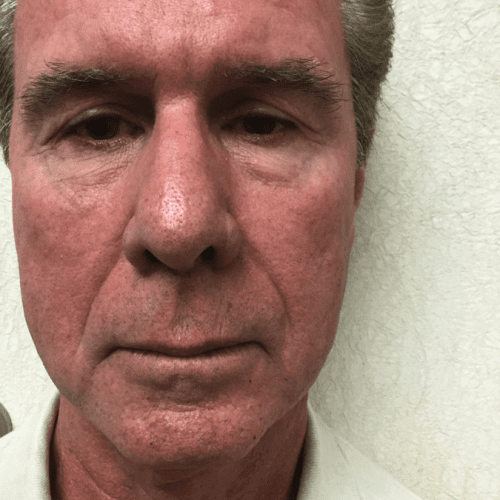 Male-Cosmetic-Surgery-10 | Before Male Cosmetic Surgery