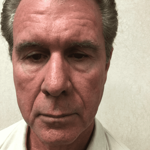 Male-Cosmetic-Surgery-10 | Before Male Cosmetic Surgery 2